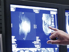 Agfa Healthcare